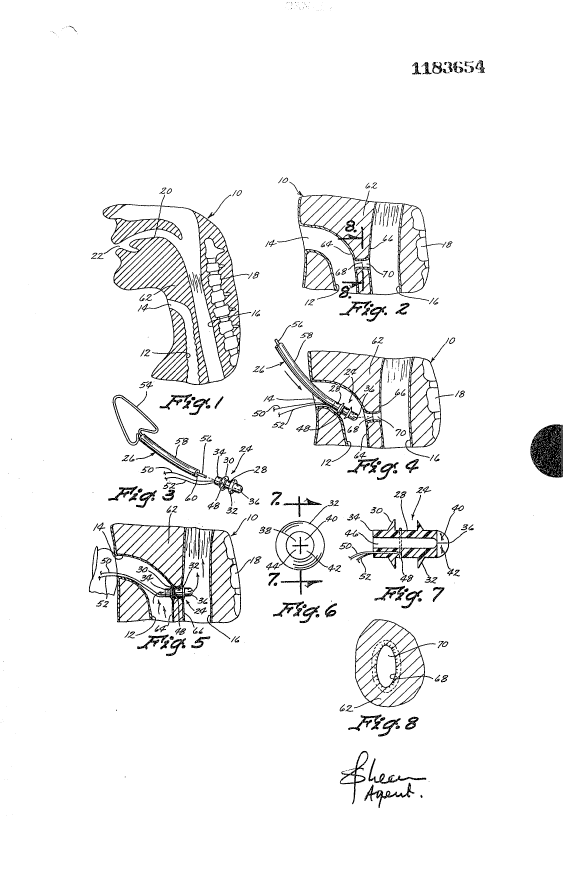 Document de brevet canadien 1183654. Dessins 19931018. Image 1 de 1