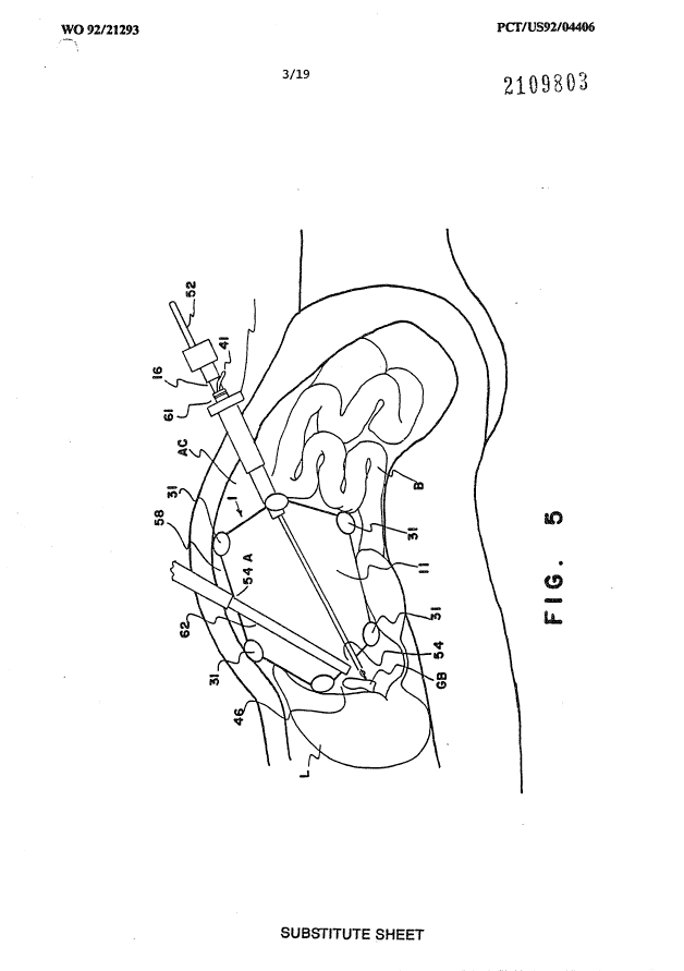 Canadian Patent Document 2109803. Drawings 19951217. Image 3 of 19