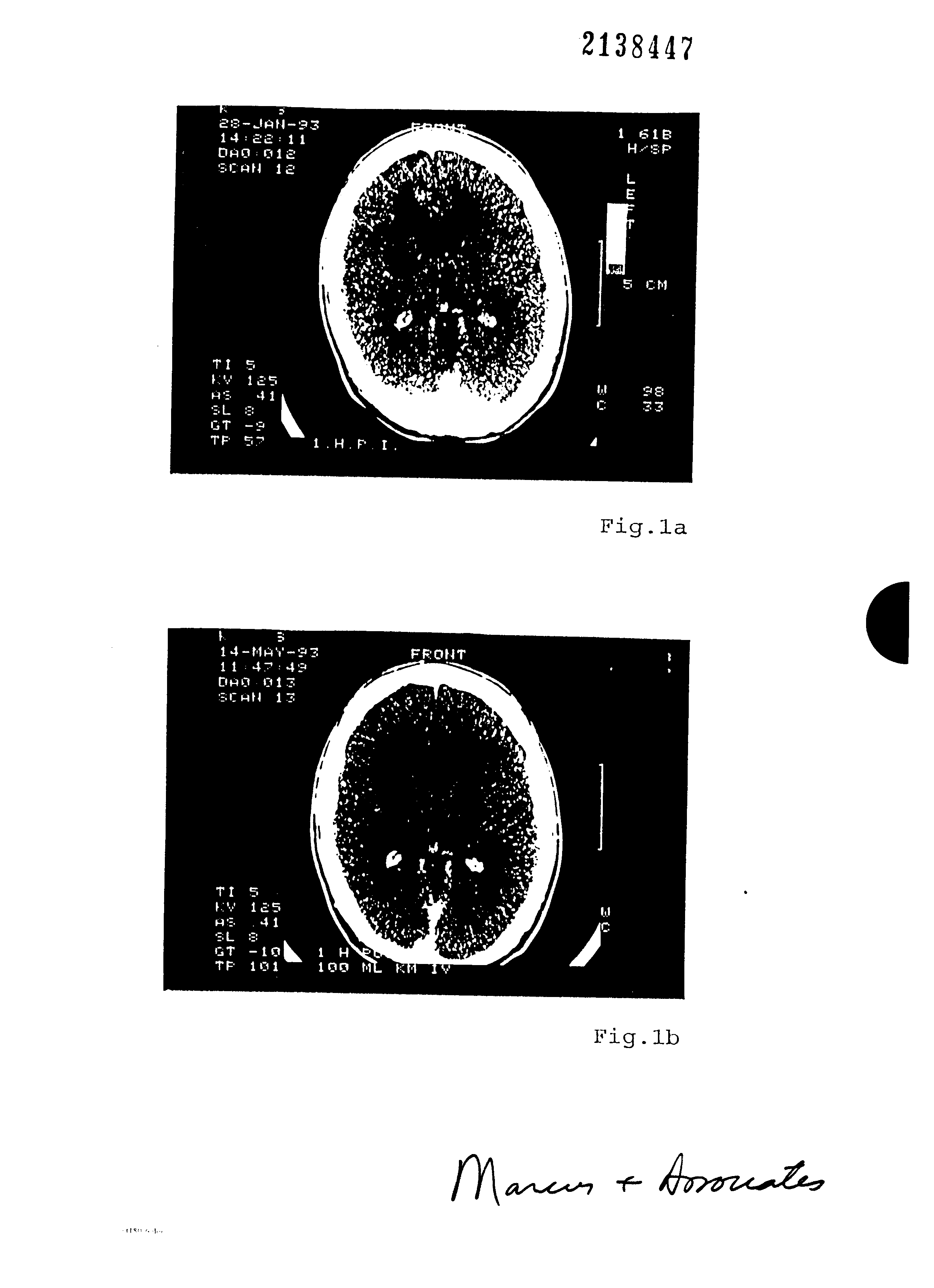 Canadian Patent Document 2138447. Drawings 19941216. Image 1 of 3