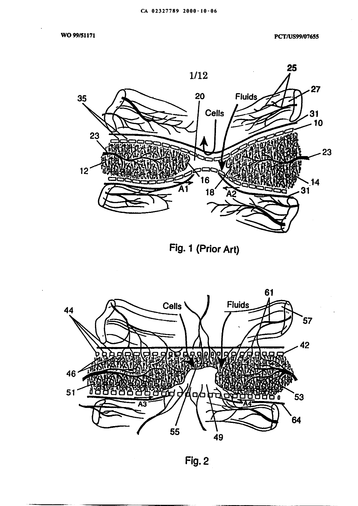 Canadian Patent Document 2327789. Drawings 20001006. Image 1 of 12