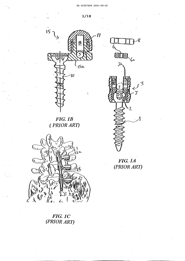 Canadian Patent Document 2357606. Drawings 20010920. Image 1 of 10
