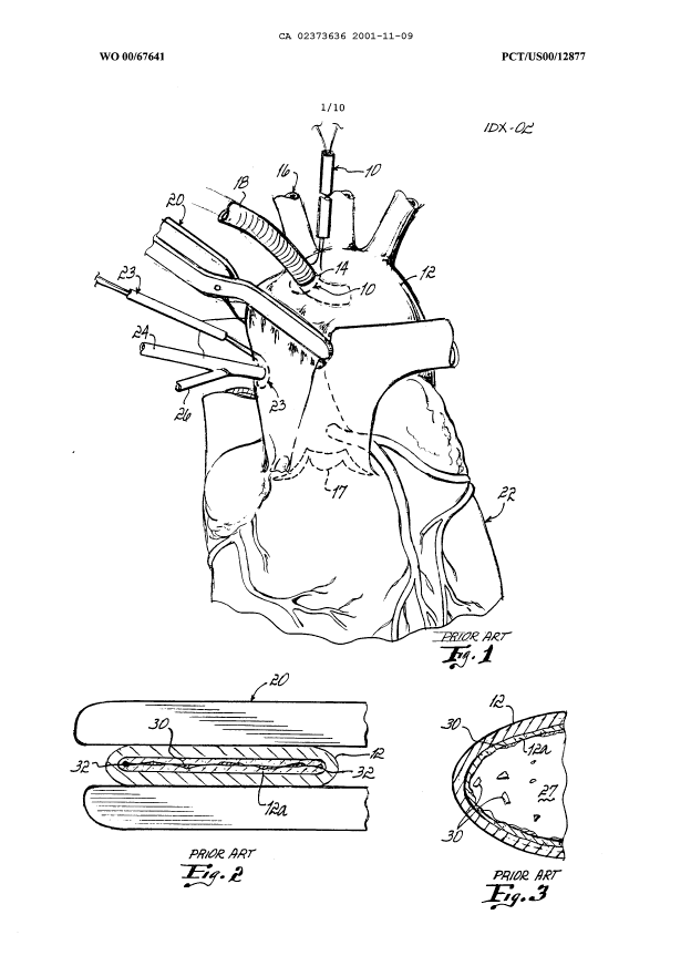 Canadian Patent Document 2373636. Drawings 20001209. Image 1 of 10
