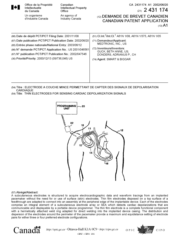 Canadian Patent Document 2431174. Cover Page 20030808. Image 1 of 1