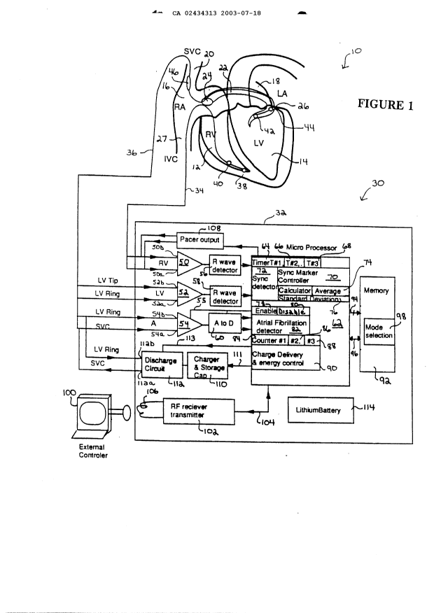 Canadian Patent Document 2434313. Drawings 20030718. Image 1 of 15