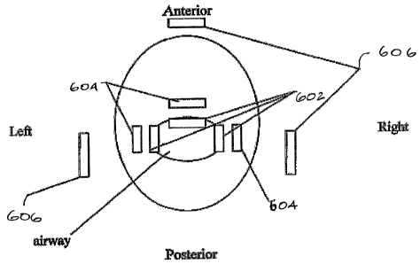 Canadian Patent Document 2544301. Representative Drawing 20051214. Image 1 of 1