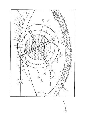 Canadian Patent Document 2588843. Representative Drawing 20160511. Image 1 of 1