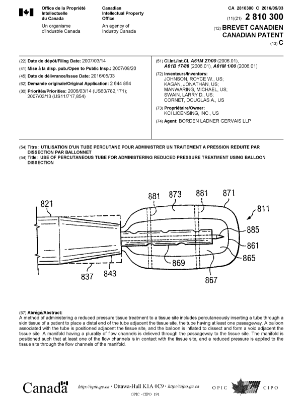 Canadian Patent Document 2810300. Cover Page 20151221. Image 1 of 1