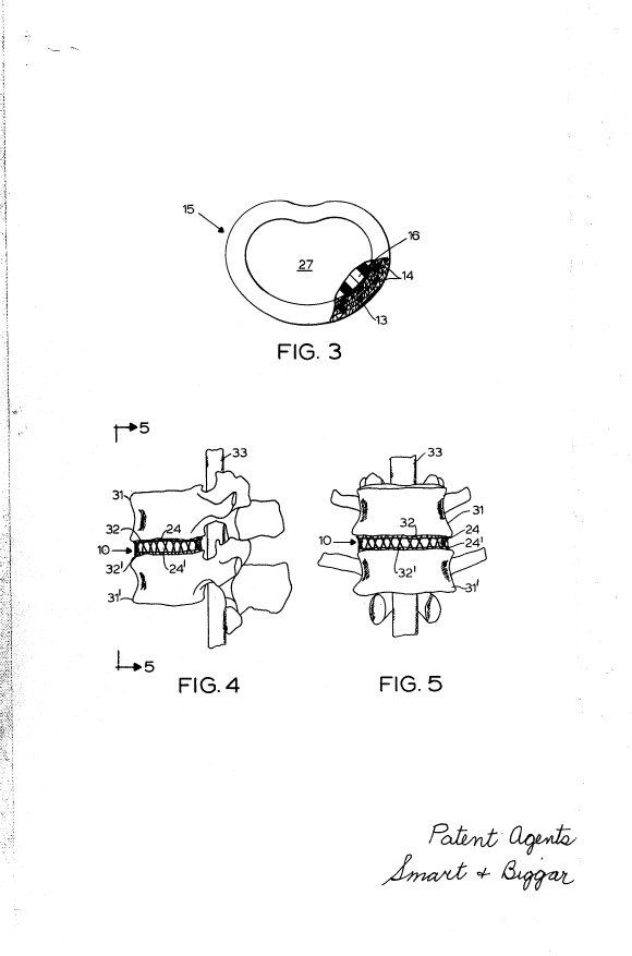 Canadian Patent Document 992255. Drawings 19940617. Image 2 of 5