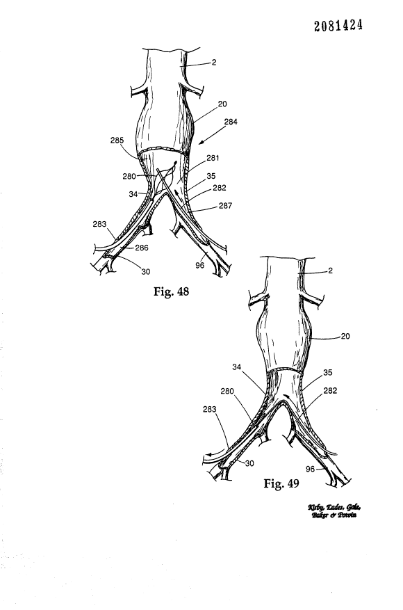 Canadian Patent Document 2081424. Drawings 19940205. Image 23 of 23