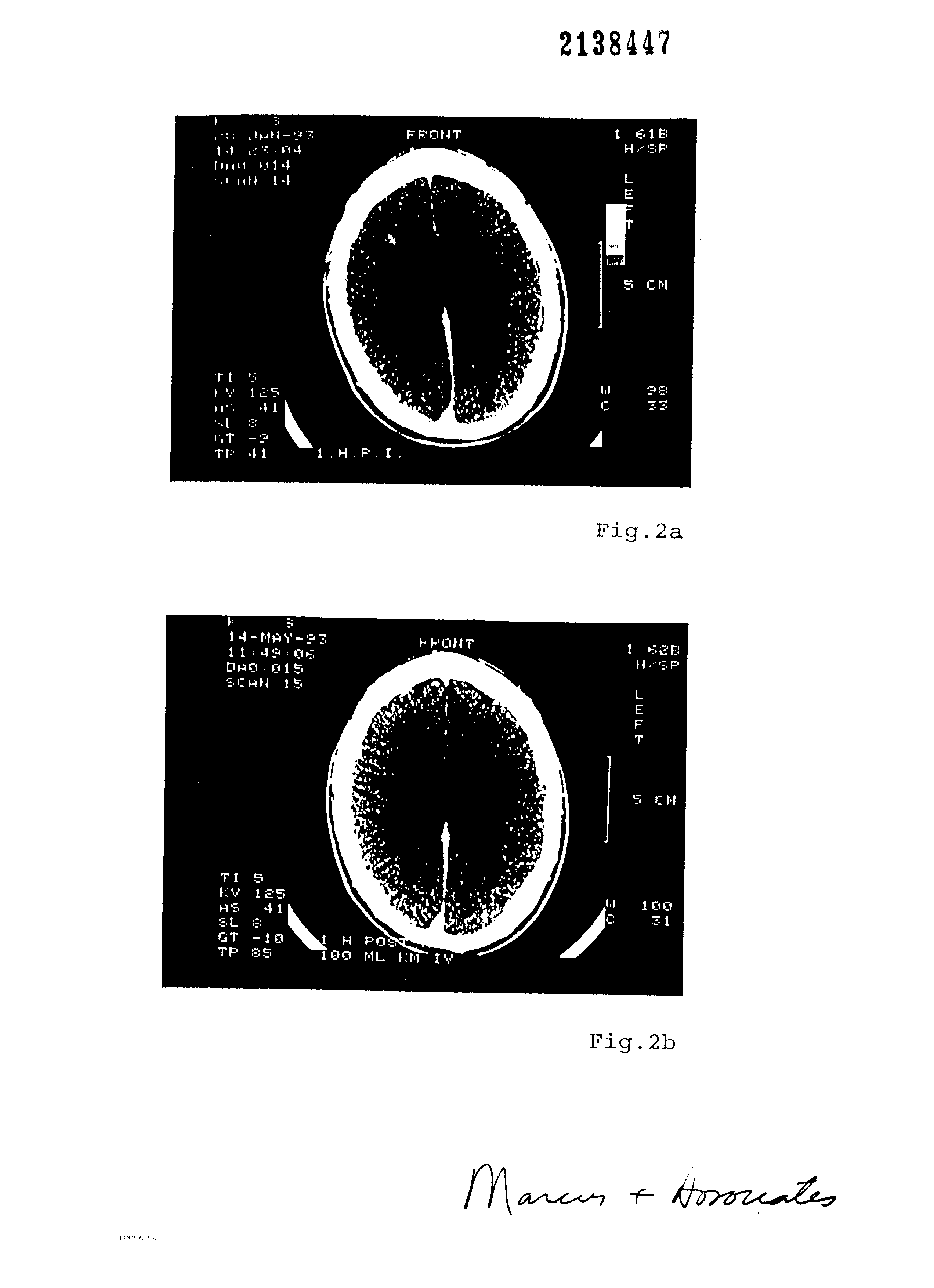 Canadian Patent Document 2138447. Drawings 19941216. Image 2 of 3