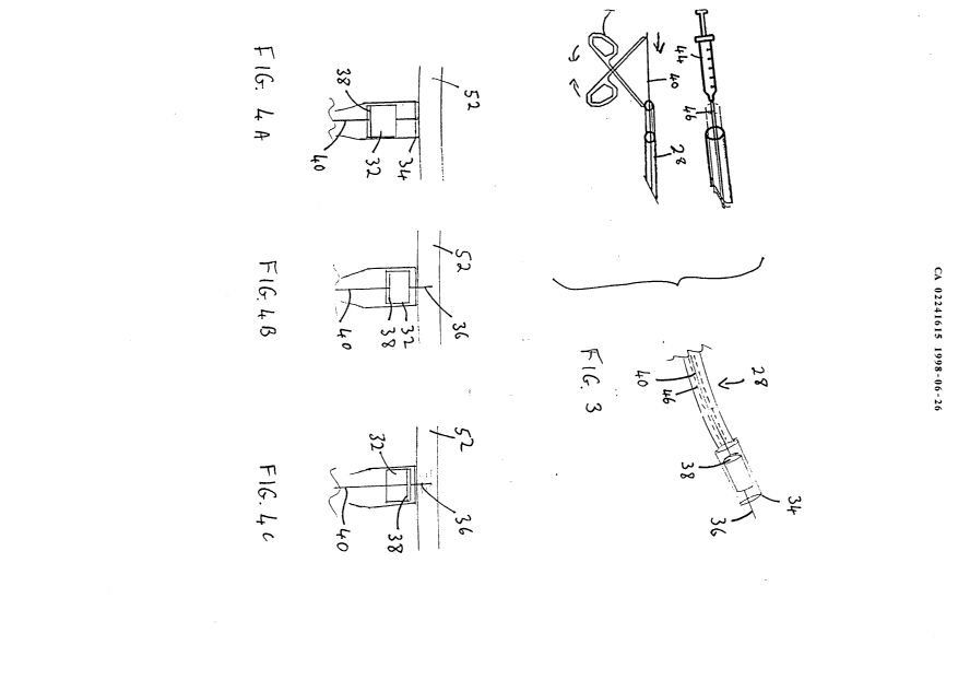 Canadian Patent Document 2241615. Drawings 19980626. Image 2 of 5