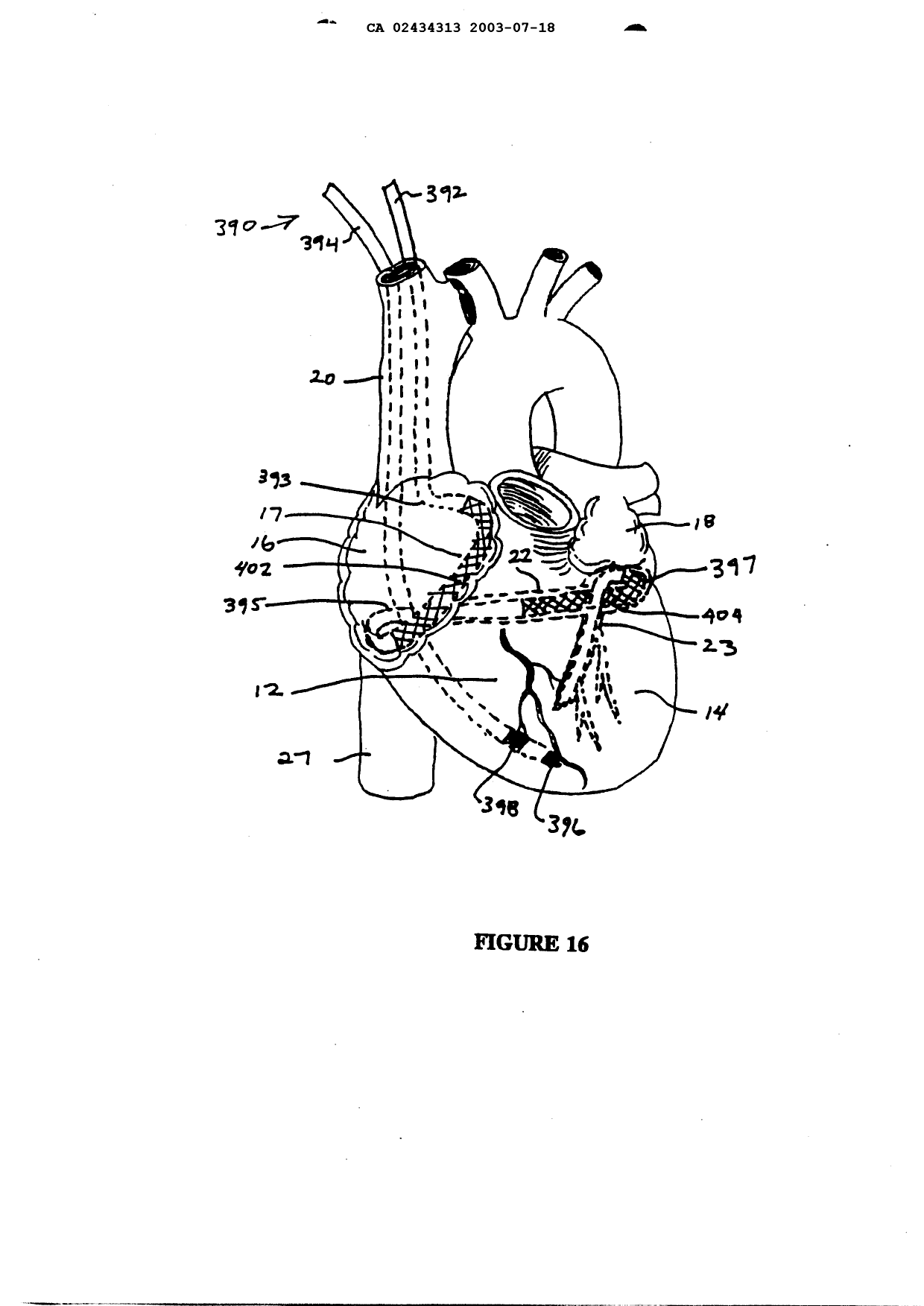 Canadian Patent Document 2434313. Drawings 20030718. Image 15 of 15