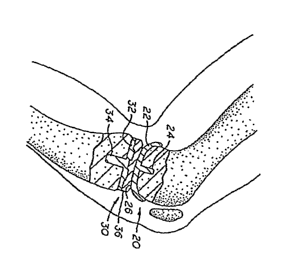 Canadian Patent Document 2454346. Representative Drawing 20040116. Image 1 of 1