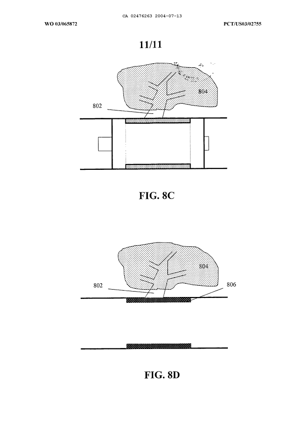 Canadian Patent Document 2476263. Drawings 20040713. Image 11 of 11