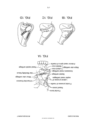 Canadian Patent Document 2902468. Drawings 20210720. Image 1 of 72
