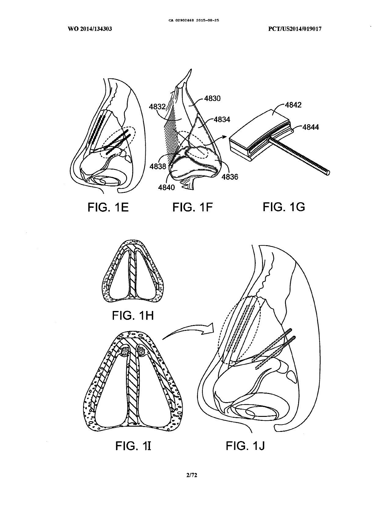 Canadian Patent Document 2902468. Drawings 20210720. Image 2 of 72