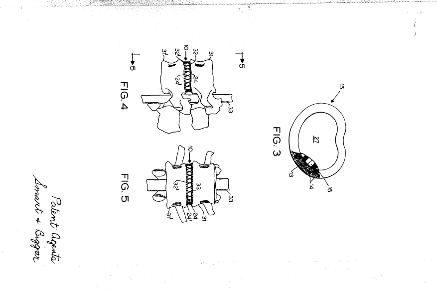 Canadian Patent Document 992255. Drawings 19940617. Image 2 of 5